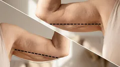 Schlaffe Oberarme? 3 einfache Übungen von einem Fitnesstrainer